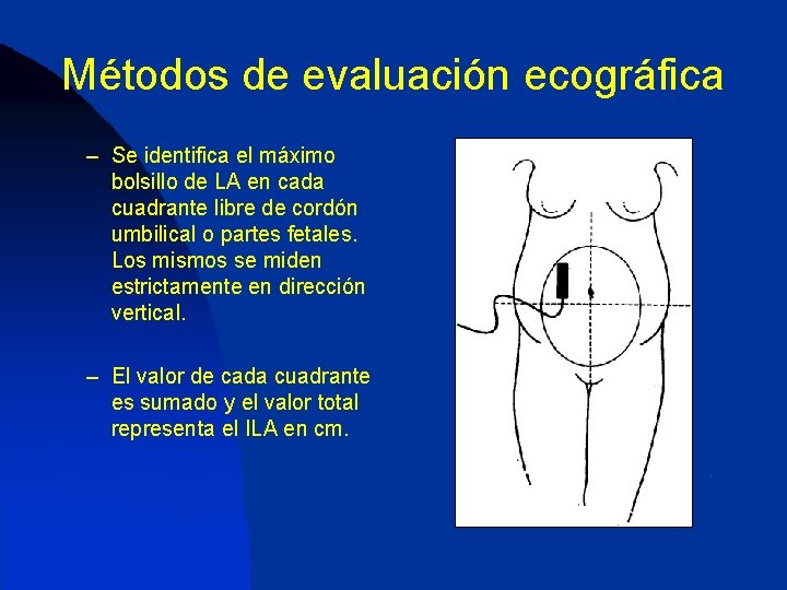 Métodos de evaluación ecográfica – Se identifica el máximo bolsillo de LA en cada