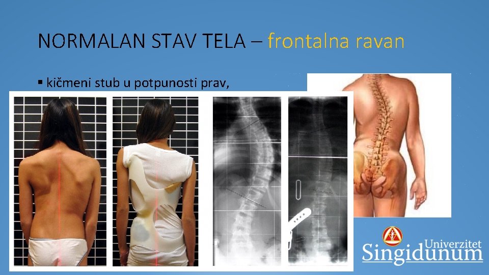 NORMALAN STAV TELA – frontalna ravan § kičmeni stub u potpunosti prav, ramena i