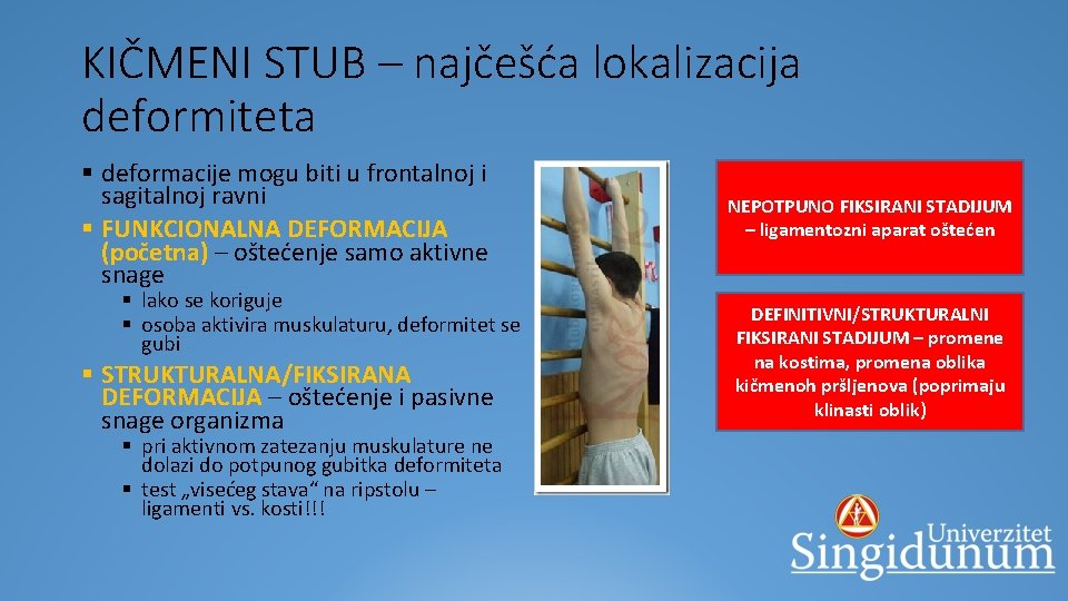 KIČMENI STUB – najčešća lokalizacija deformiteta § deformacije mogu biti u frontalnoj i sagitalnoj