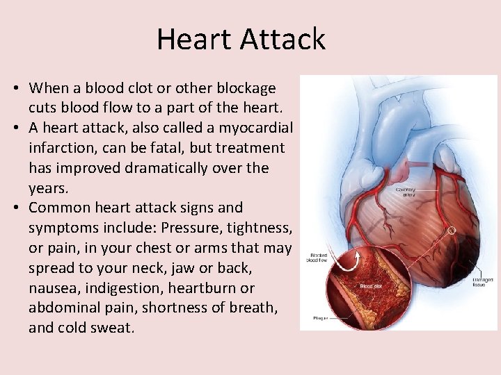 Heart Attack • When a blood clot or other blockage cuts blood flow to