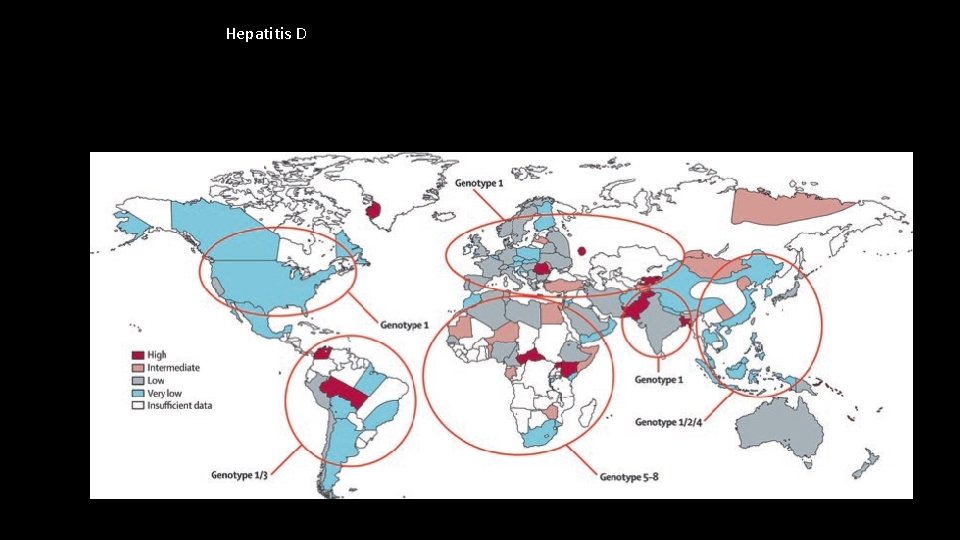 Hepatitis D 