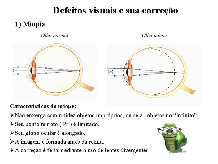 Defeitos visuais e sua correção 1) Miopia Características do míope: ØNão enxerga com nitidez