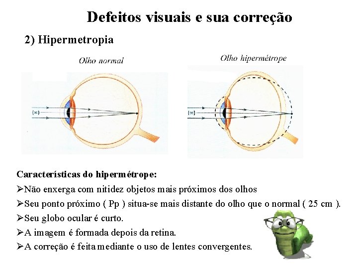 Defeitos visuais e sua correção 2) Hipermetropia Características do hipermétrope: ØNão enxerga com nitidez