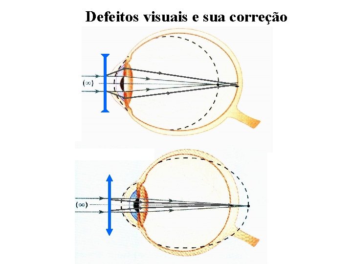 Defeitos visuais e sua correção 