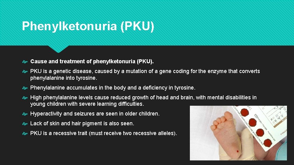 Phenylketonuria (PKU) Cause and treatment of phenylketonuria (PKU). PKU is a genetic disease, caused