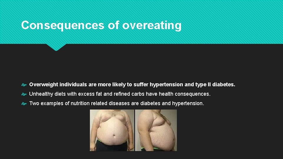 Consequences of overeating Overweight individuals are more likely to suffer hypertension and type II