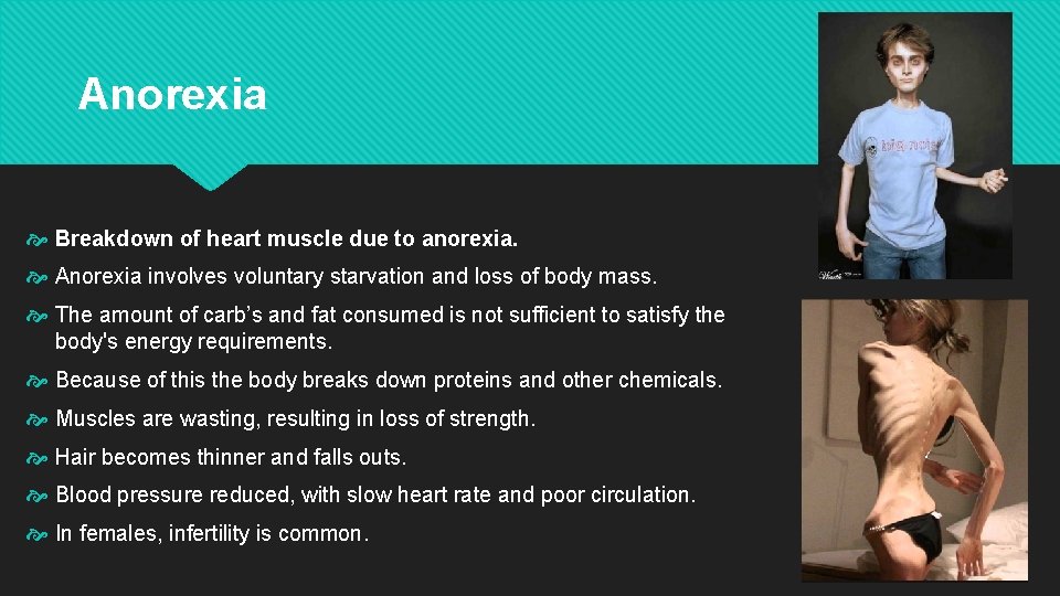 Anorexia Breakdown of heart muscle due to anorexia. Anorexia involves voluntary starvation and loss