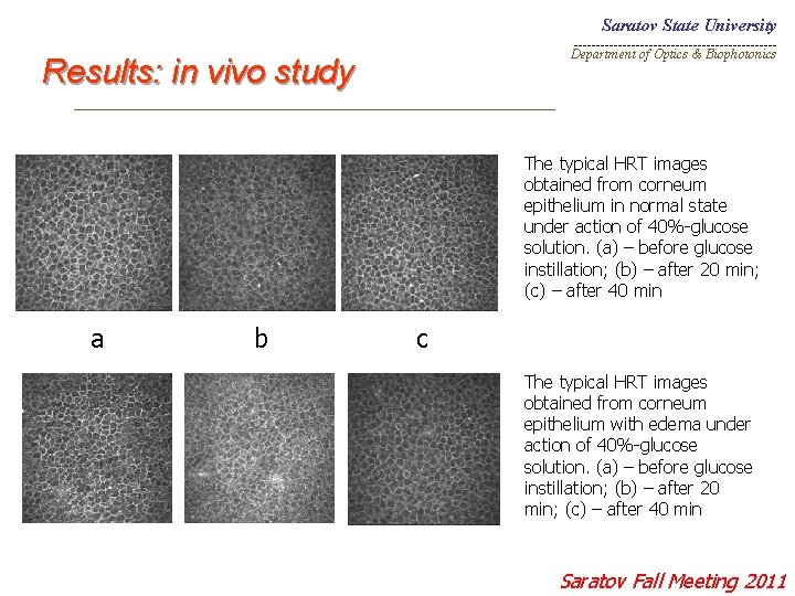 Saratov State University _______________________ Department of Optics & Biophotonics Results: in vivo study _________________________