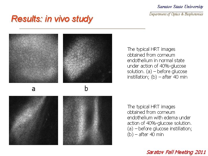 Saratov State University _______________________ Results: in vivo study Department of Optics & Biophotonics _________________________