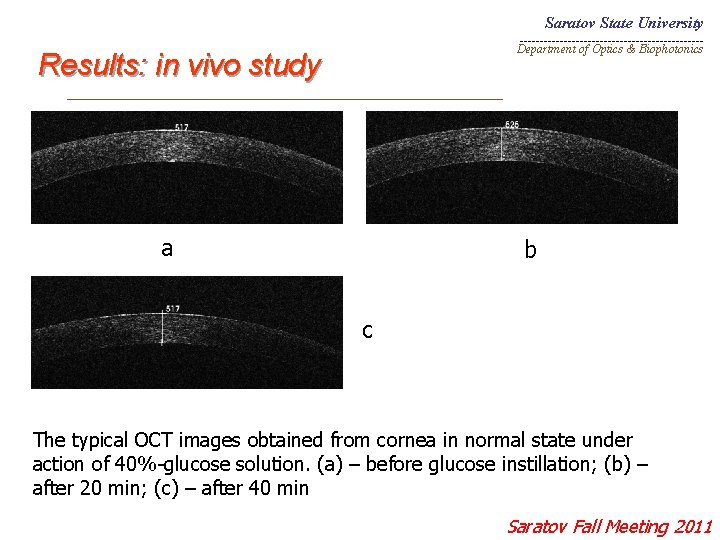 Saratov State University _______________________ Department of Optics & Biophotonics Results: in vivo study _________________________