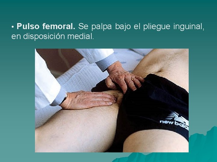  • Pulso femoral. Se palpa bajo el pliegue inguinal, en disposición medial. 