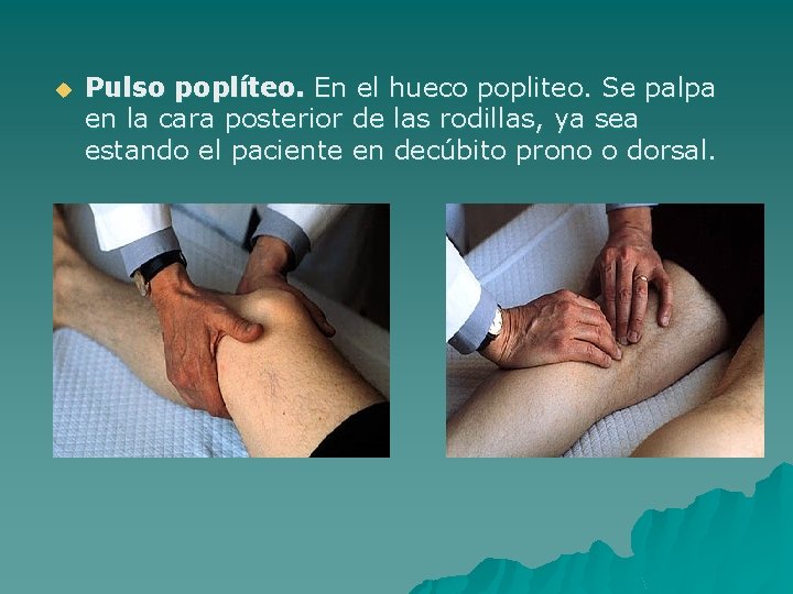 u Pulso poplíteo. En el hueco popliteo. Se palpa en la cara posterior de