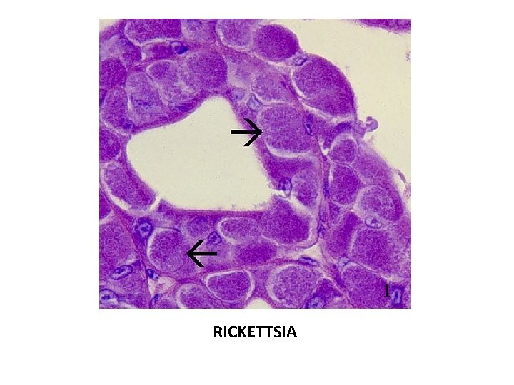 RICKETTSIA 