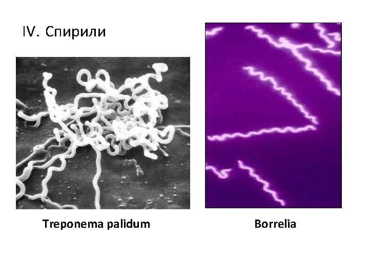 IV. Спирили Treponema palidum Borrelia 