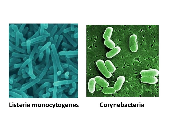 Listeria monocytogenes Corynebacteria 