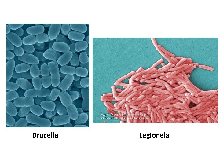 Brucella Legionela 