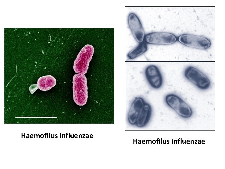 Haemofilus influenzae 