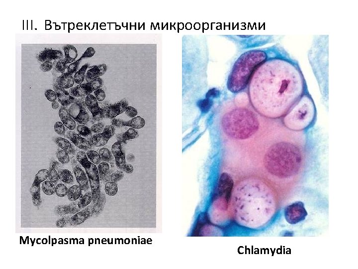 III. Вътреклетъчни микроорганизми Mycolpasma pneumoniae Chlamydia 