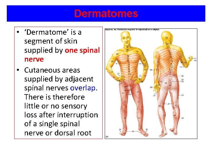 Dermatomes • ‘Dermatome’ is a segment of skin supplied by one spinal nerve •