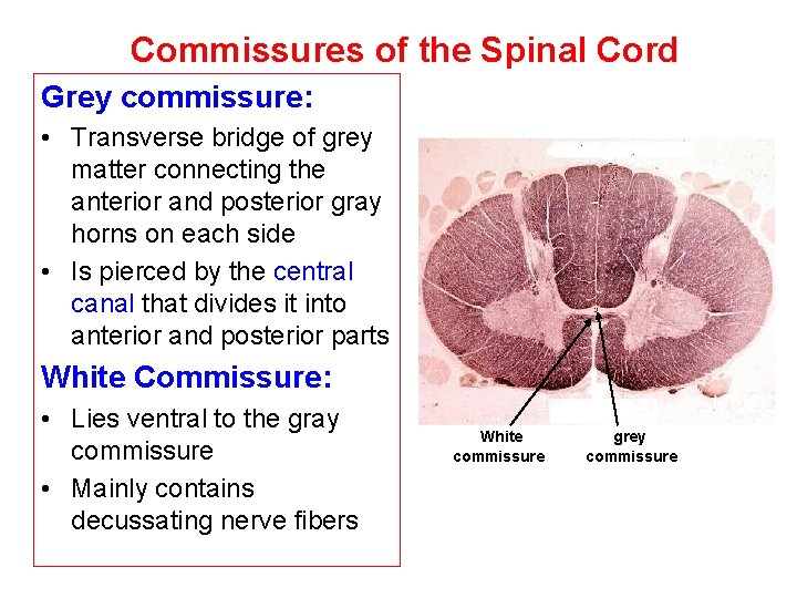 Commissures of the Spinal Cord Grey commissure: • Transverse bridge of grey matter connecting