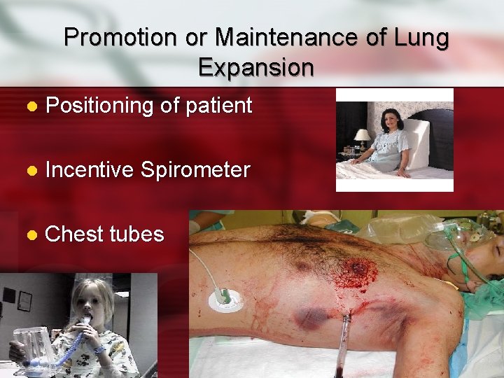 Promotion or Maintenance of Lung Expansion l Positioning of patient l Incentive Spirometer l