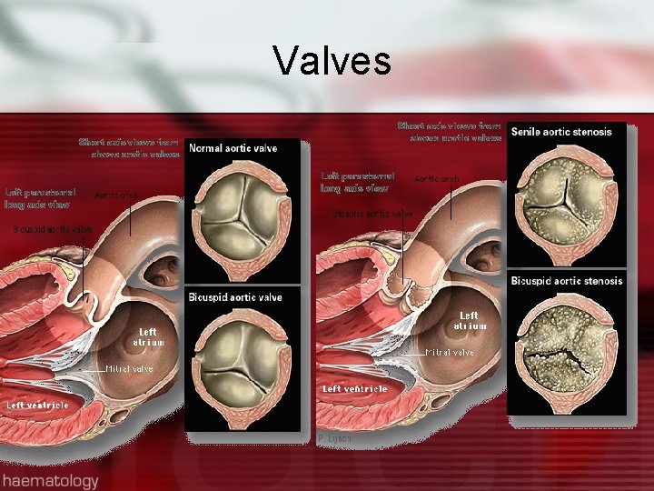 Valves 