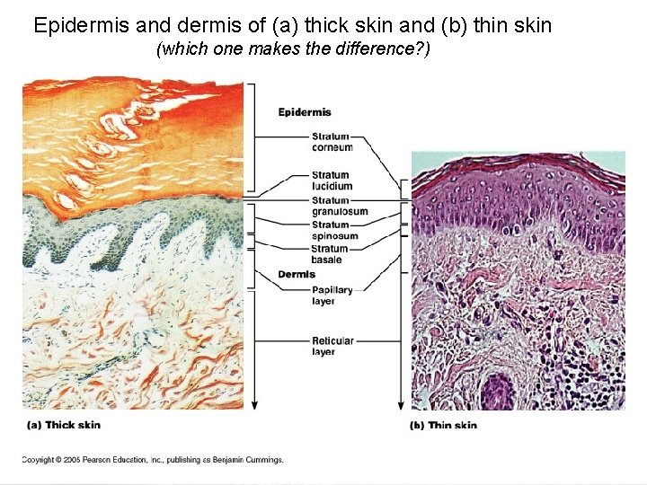 Epidermis and dermis of (a) thick skin and (b) thin skin (which one makes