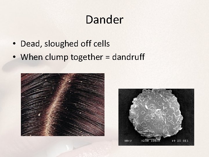 Dander • Dead, sloughed off cells • When clump together = dandruff 
