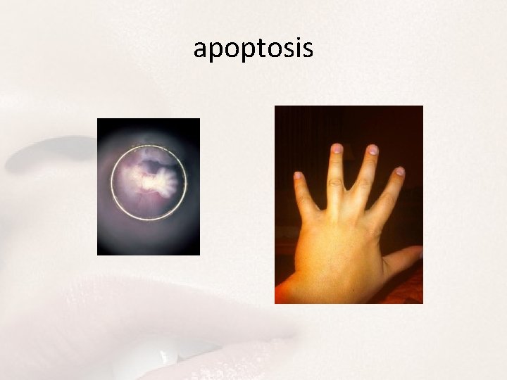 apoptosis 