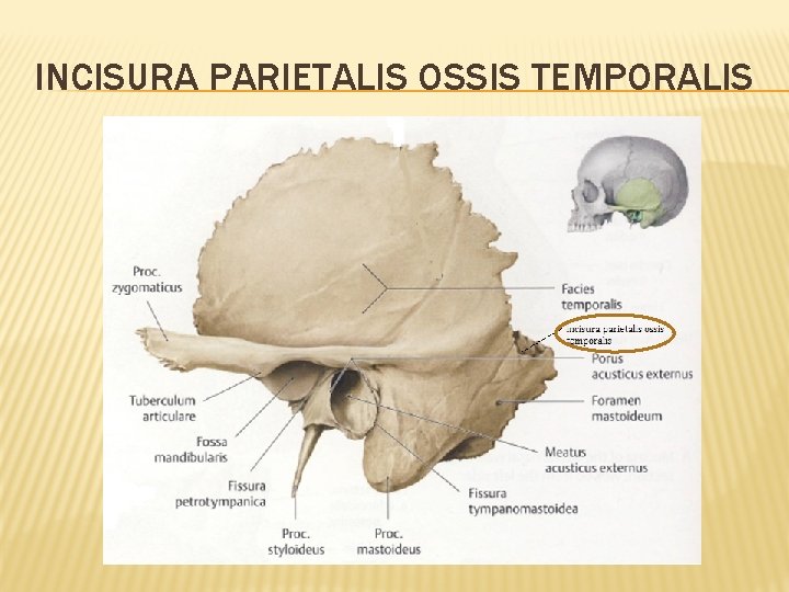 INCISURA PARIETALIS OSSIS TEMPORALIS 