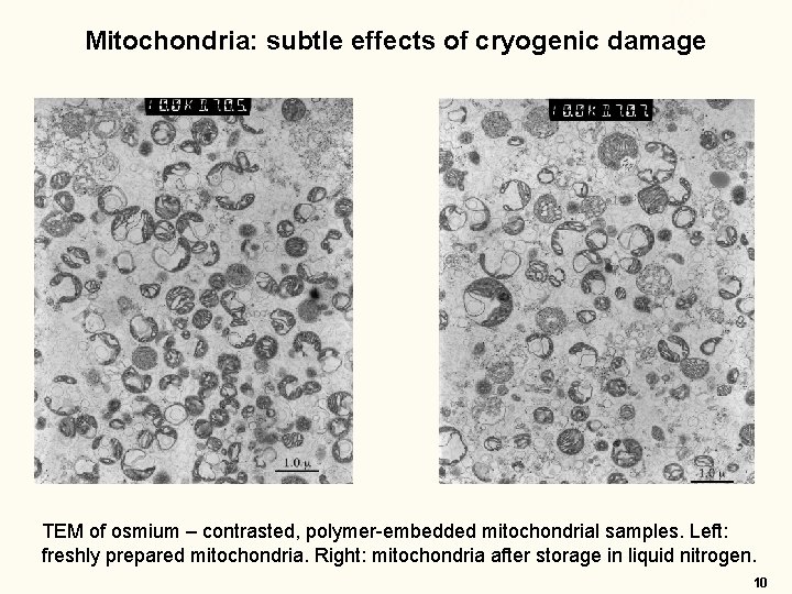 Mitochondria: subtle effects of cryogenic damage TEM of osmium – contrasted, polymer-embedded mitochondrial samples. Mitochondria: subtle effects of cryogenic damage TEM of osmium – contrasted, polymer-embedded mitochondrial samples.