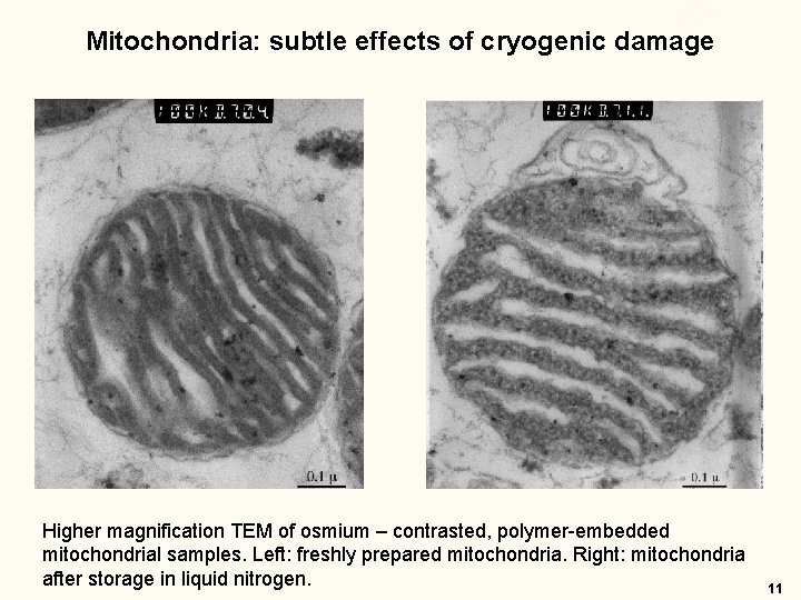 Mitochondria: subtle effects of cryogenic damage Higher magnification TEM of osmium – contrasted, polymer-embedded Mitochondria: subtle effects of cryogenic damage Higher magnification TEM of osmium – contrasted, polymer-embedded