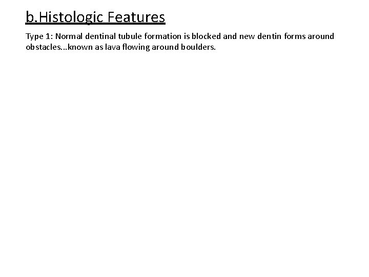 b. Histologic Features Type 1: Normal dentinal tubule formation is blocked and new dentin