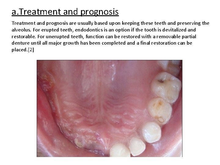 a. Treatment and prognosis are usually based upon keeping these teeth and preserving the