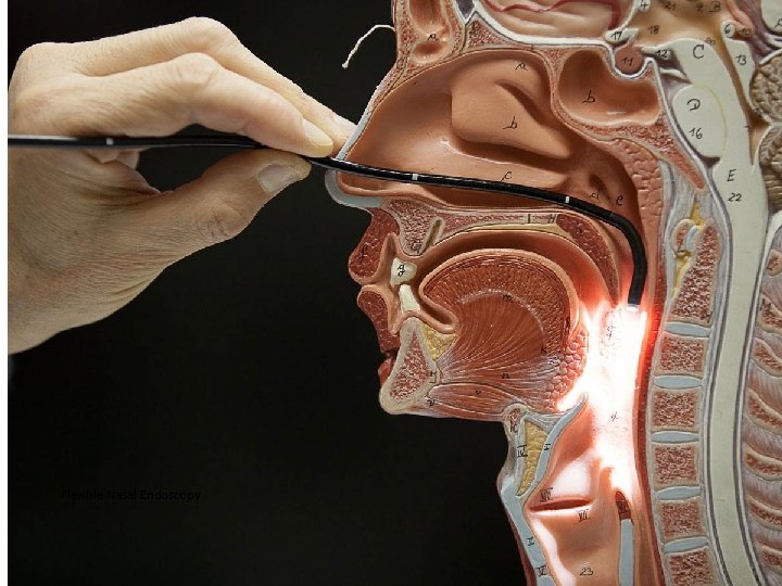 Flexible Nasal Endoscopy Eighth Annual ENT for the PA-C | April 25 – 29,