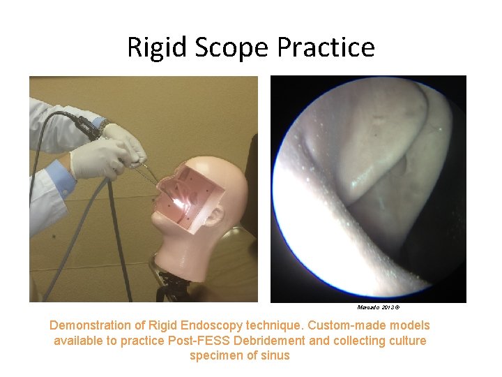 Rigid Scope Practice Mercado 2013 © Demonstration of Rigid Endoscopy technique. Custom-made models available