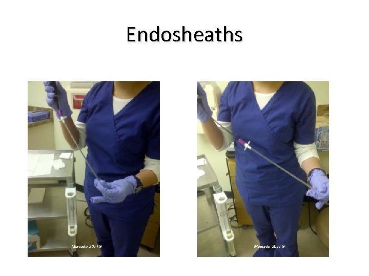 Endosheaths Loosen endosheath Mercado 2011 © Pull endosheath from distal end Mercado 2011 ©