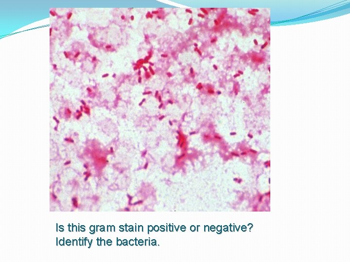 Is this gram stain positive or negative? Identify the bacteria. 
