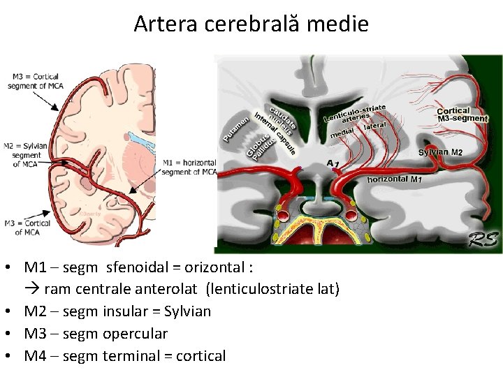 Artera cerebrală medie • M 1 – segm sfenoidal = orizontal : ram centrale