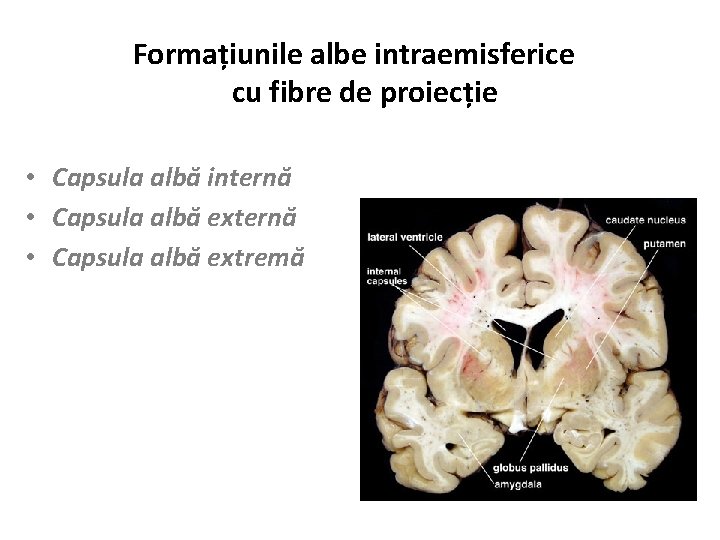 Formațiunile albe intraemisferice cu fibre de proiecție • Capsula albă internă • Capsula albă