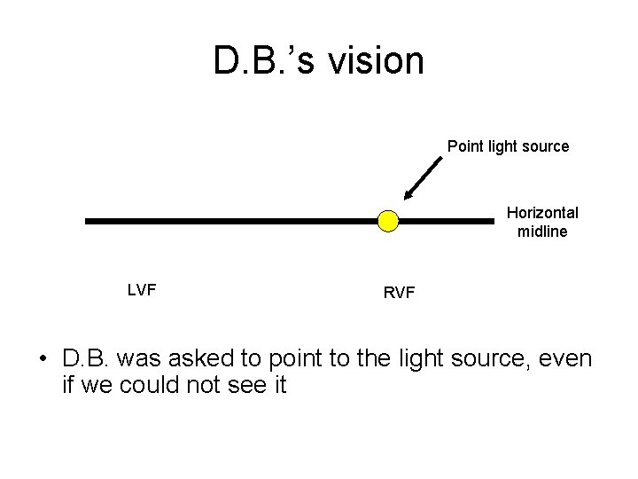 D. B. ’s vision Point light source Horizontal midline LVF RVF • D. B.