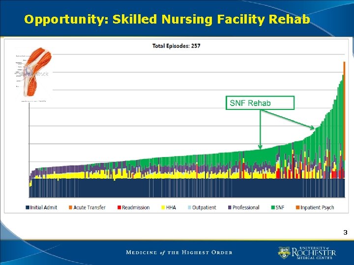 Opportunity: Skilled Nursing Facility Rehab 3 