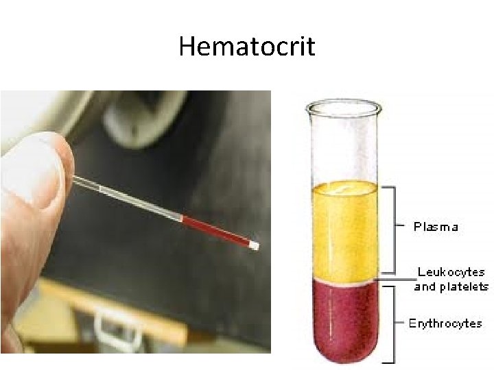 Hematocrit 