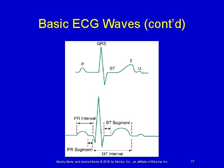 Basic ECG Waves (cont’d) Mosby items and derived items © 2010 by Mosby, Inc.