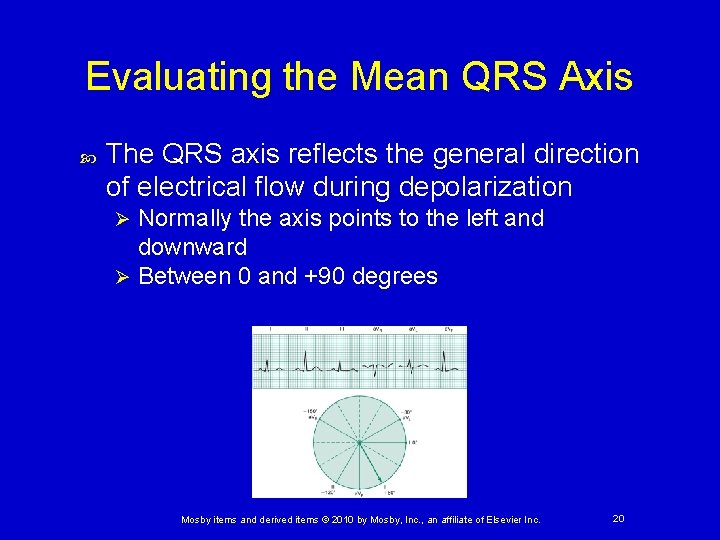 Evaluating the Mean QRS Axis The QRS axis reflects the general direction of electrical