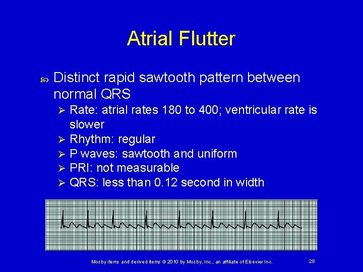 Atrial Flutter Distinct rapid sawtooth pattern between normal QRS Rate: atrial rates 180 to