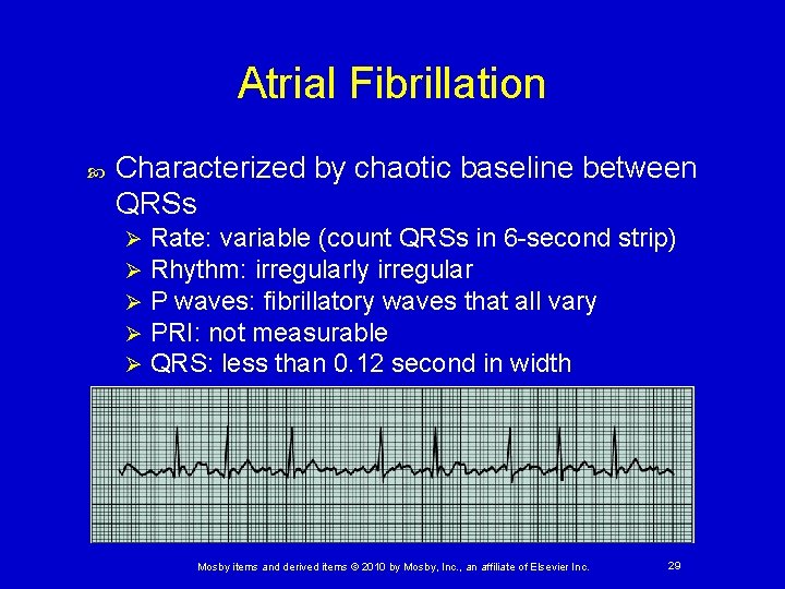 Atrial Fibrillation Characterized by chaotic baseline between QRSs Ø Ø Ø Rate: variable (count