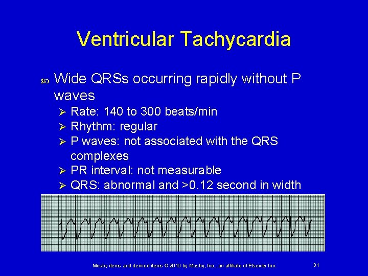 Ventricular Tachycardia Wide QRSs occurring rapidly without P waves Rate: 140 to 300 beats/min