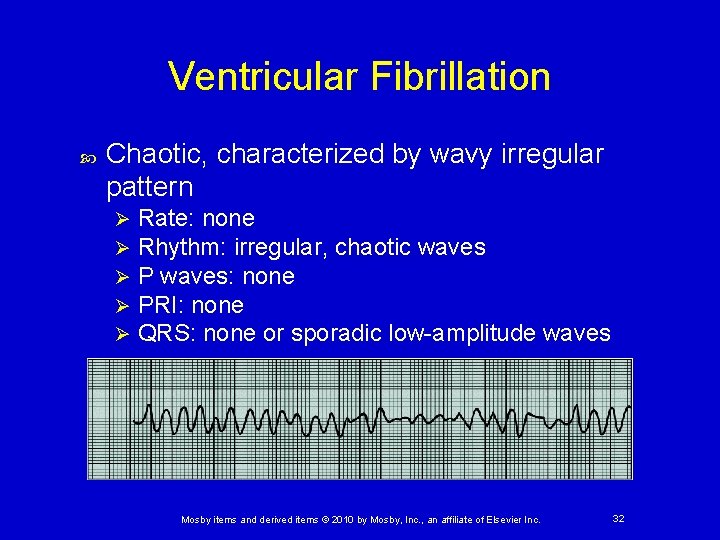 Ventricular Fibrillation Chaotic, characterized by wavy irregular pattern Ø Ø Ø Rate: none Rhythm: