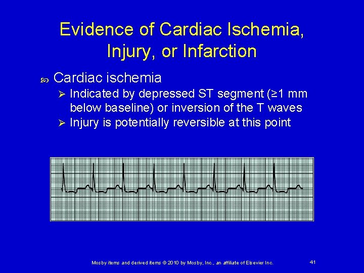 Evidence of Cardiac Ischemia, Injury, or Infarction Cardiac ischemia Indicated by depressed ST segment